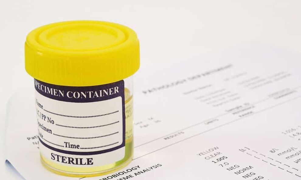 Debe facerse unha proba de orina antes de tomar antibióticos